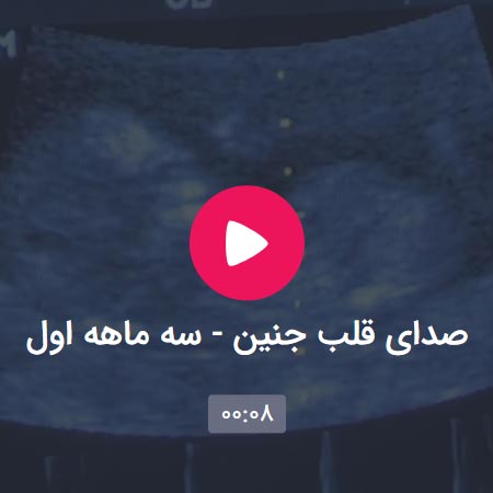 صدای قلب جنین - سه ماهه اول