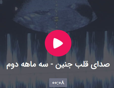 صدای قلب جنین - سه ماهه دوم