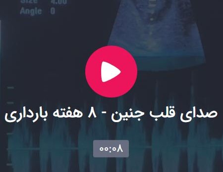 صدای قلب جنین - ٨ هفته بارداری