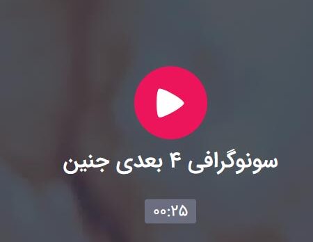 سونوگرافی ٤ بعدی جنين در سونوگرافی و رادیولوژی نگین